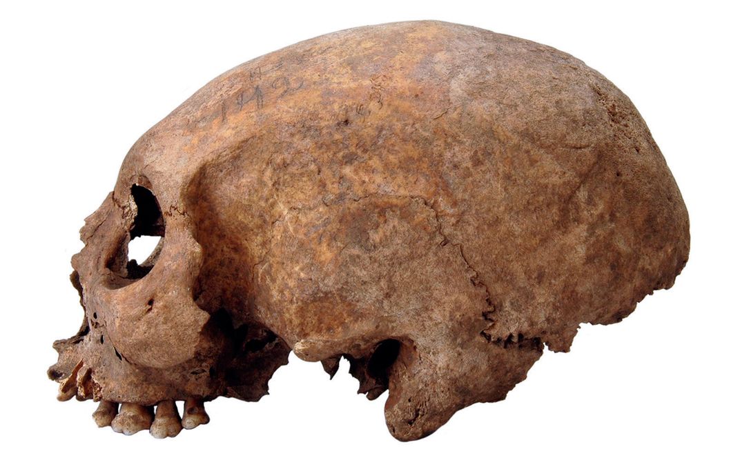 Skull